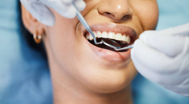 Best Emergency Root Canal Treatment in Pinehurst, TX